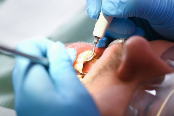 Best Emergency Dental Care for Broken or Chipped Teeth in Bayou Blue, LA