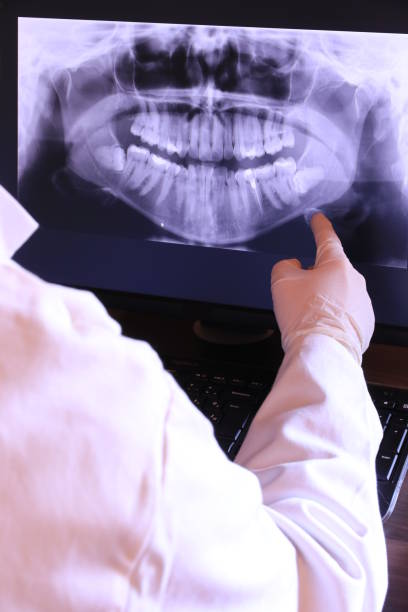 Best Urgent Care for Lost Fillings or Crowns in Bayou Blue, LA