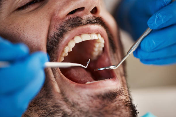 Best Emergency Denture Repair in Bayou Blue, LA